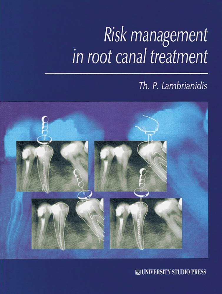 Risk Management in Root Canal Treatment